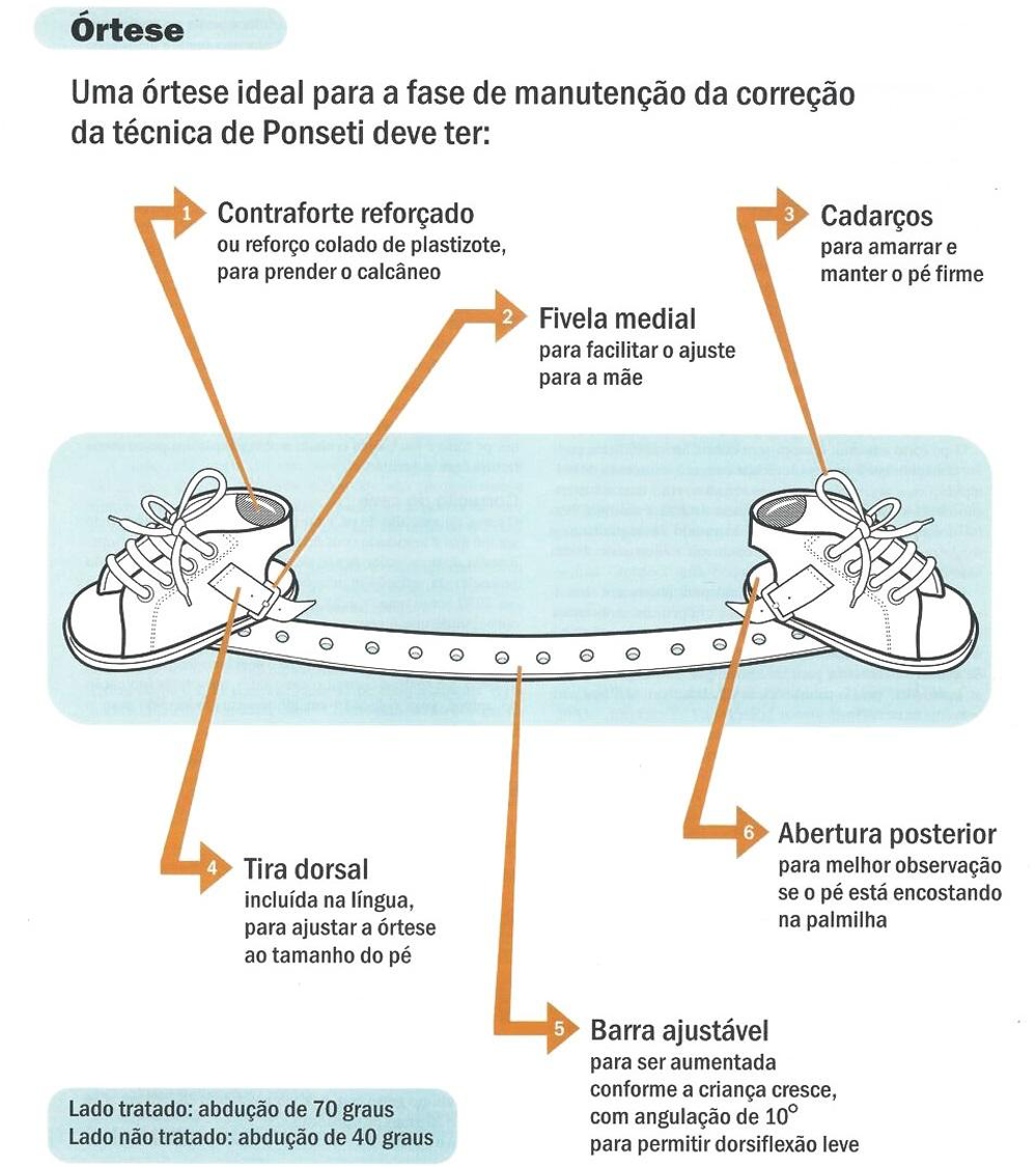 Como utilizar a órtese de Dennis-Brown?